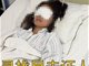 女孩玩漂流被人用高压水枪击伤眼睛